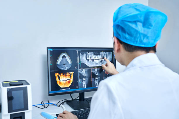 Best Emergency Wisdom Tooth Extraction in Saucier, MS